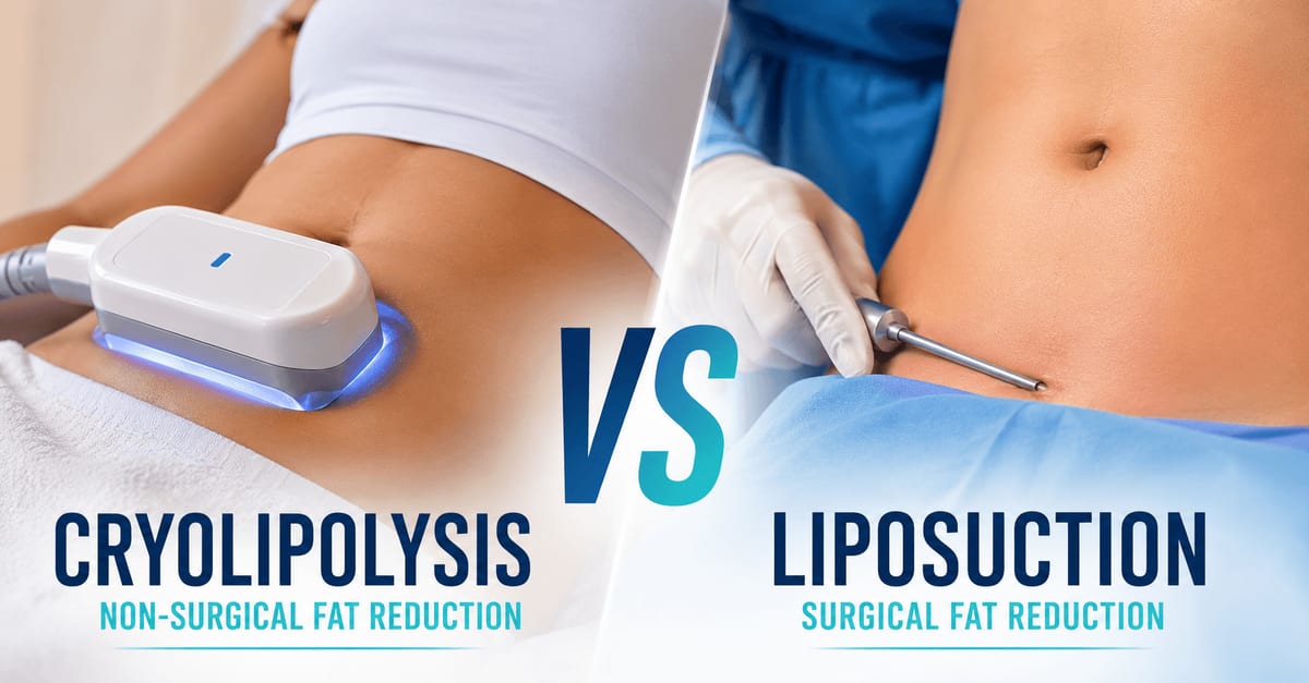 Comparison of Cryolipolysis and Liposuction for stubborn fat reduction in an Indian patient undergoing body contouring treatment.