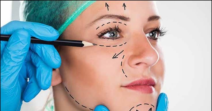 Surgeon in blue gloves marking a woman’s face with dotted lines before a cosmetic procedure.