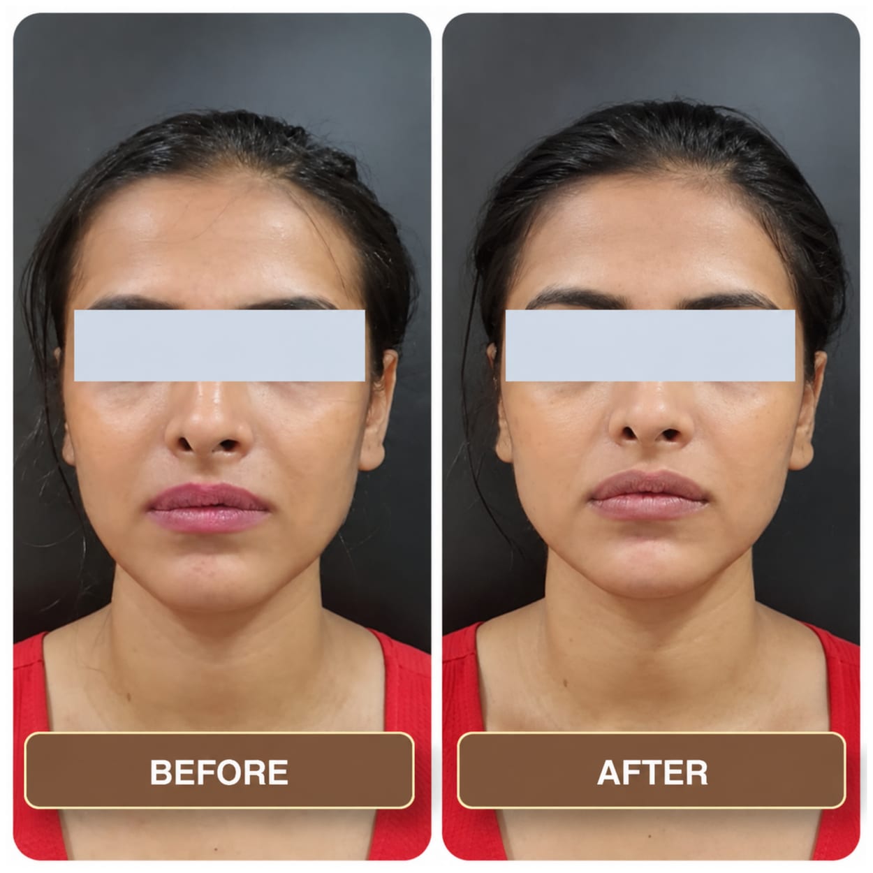 A woman photographed front-on twice against a dark studio backdrop, the two shots side by side and labelled Before and After