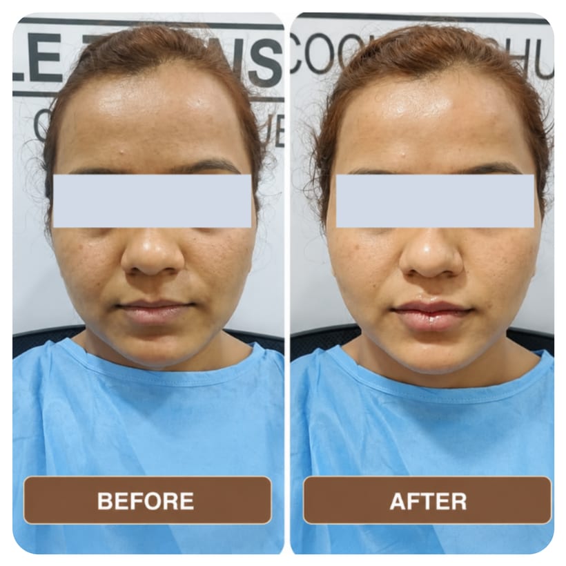 A woman in a blue clinic gown photographed front-on twice against a clinic wall, the two shots side by side and labelled Before and After