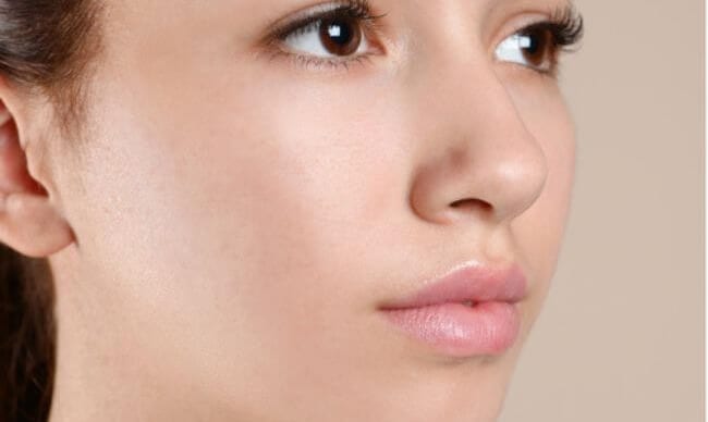 The same cheek with clearer, smoother skin after treatment