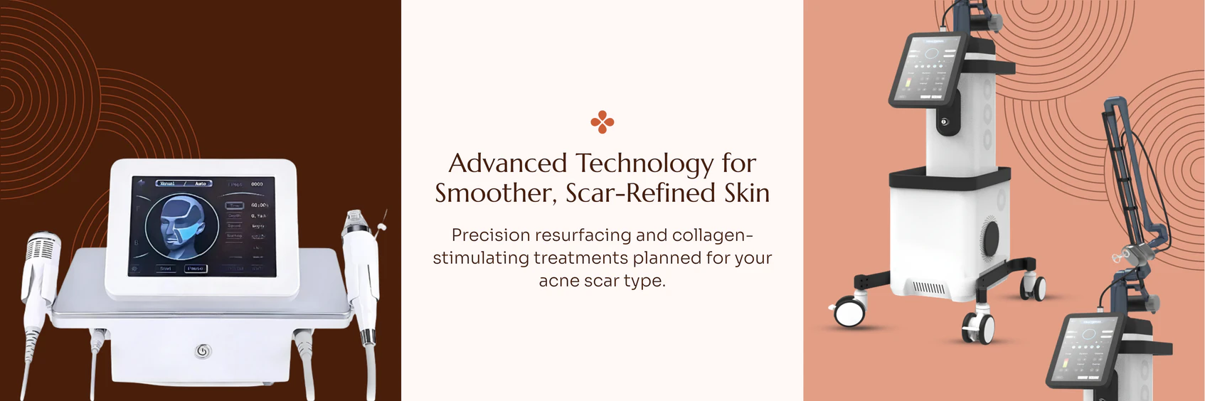 Acne Scar Treatment treatment technology and care information
