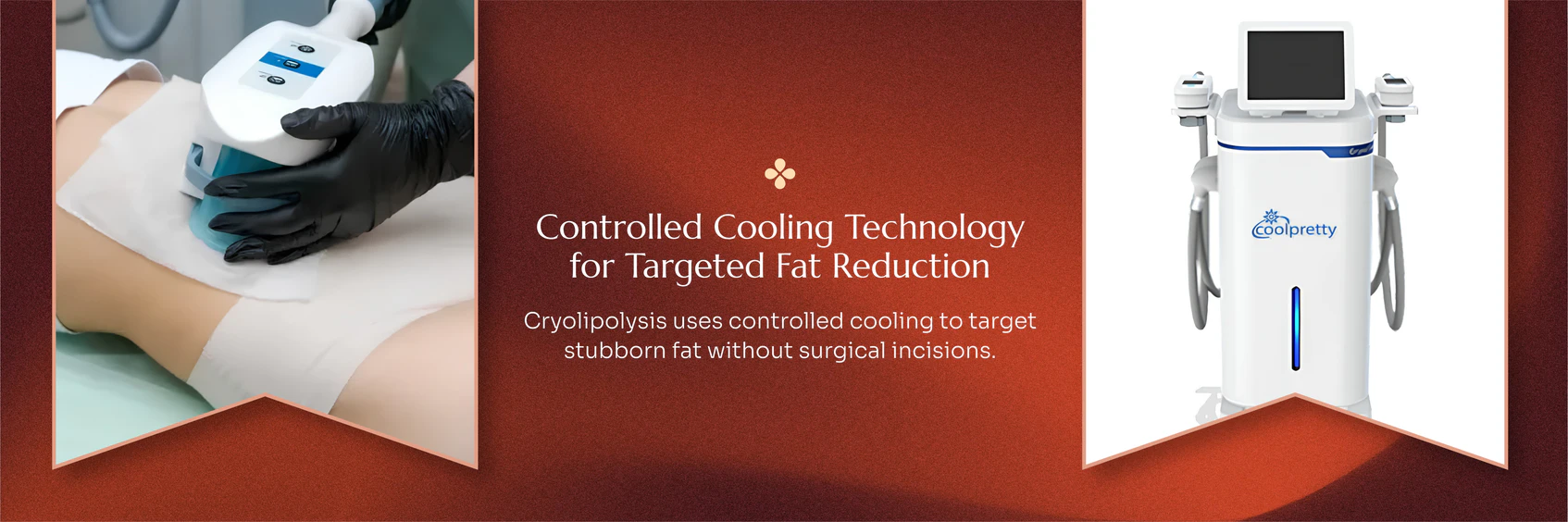 Cryolipolysis treatment technology and care information
