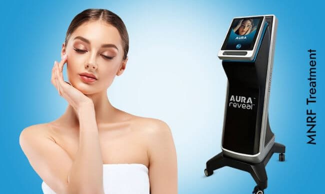 MNRF microneedling radiofrequency machine