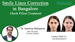 Dermal Fillers For Smile Lines Correction in Bangalore